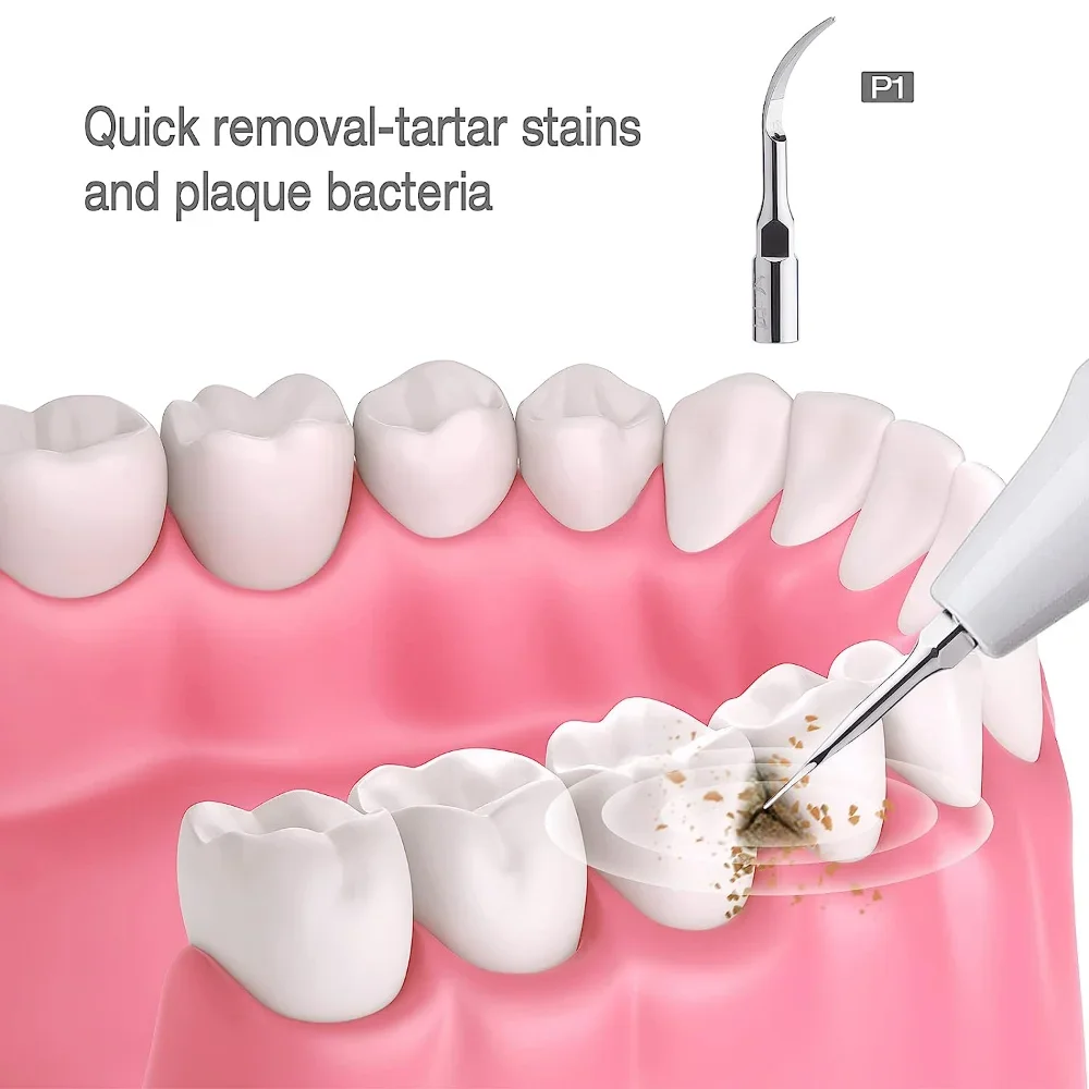 ELIJAH Dental Sugragingival Sc - Thermal Paste recensie en prijs