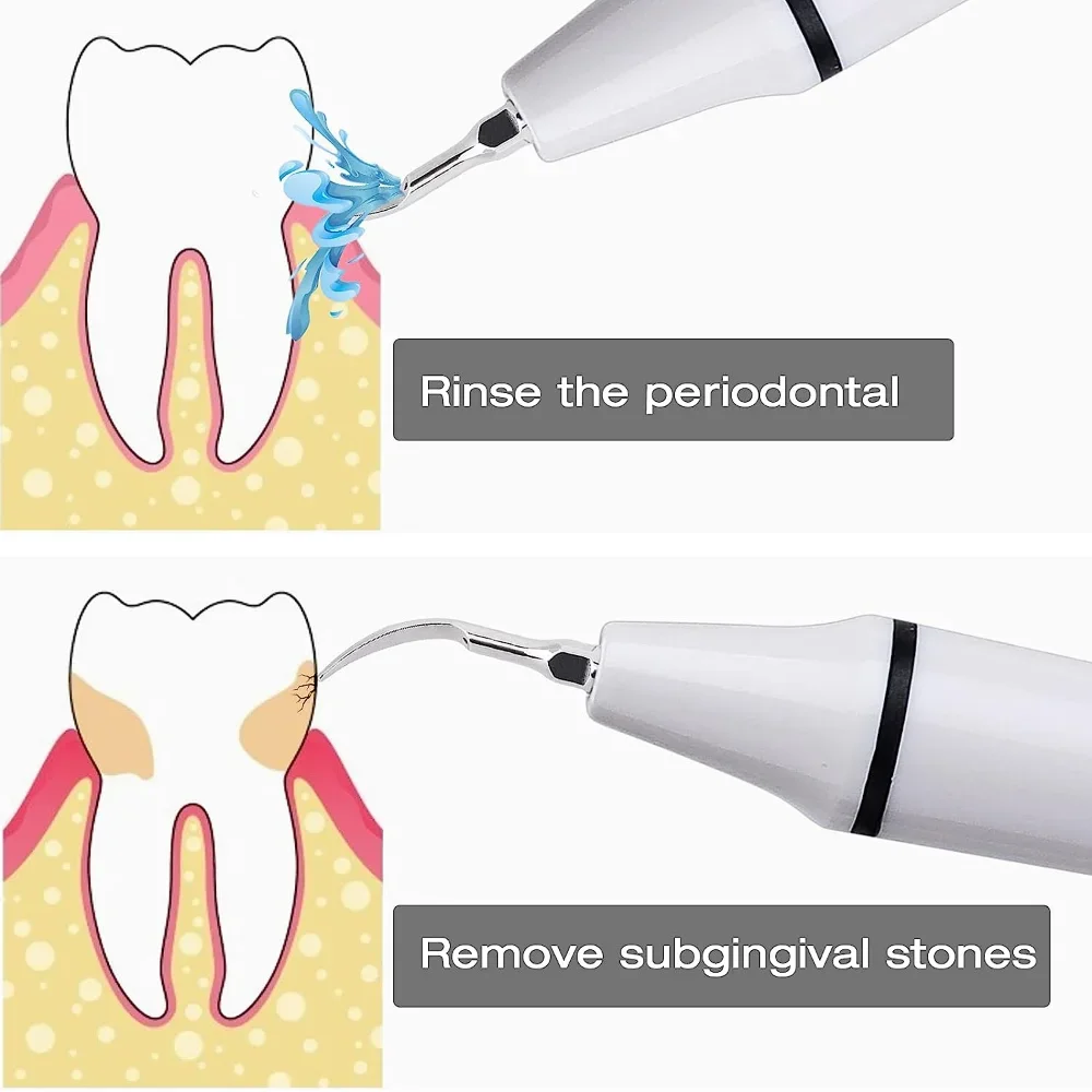 ELIJAH Dental Sugragingival Sc - Thermal Paste recensie en prijs