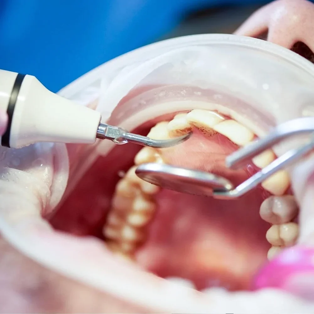 ELIJAH Dental Sugragingival Sc - Thermal Paste recensie en prijs